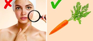 De que nossa pele precisa nos dias frios de inverno?