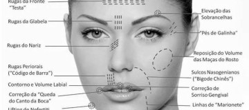 Harmonização facial – O que precisa saber?