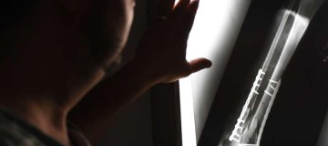 Mulher cai em buraco sem sinalização em MG, se machuca e é indenizada