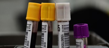 Hemorio inicia testes com plasma sanguíneo no tratamento de covid-19