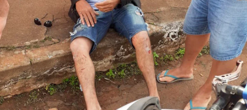 Homem é atacado por cão da raça pitbull em Patos de Minas