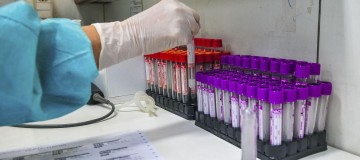 Hospital investiga se pacientes foram reinfectados pelo coronavírus
