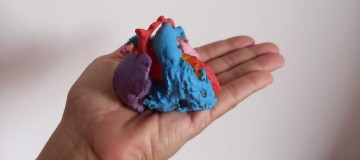 Médicos usam impressora 3D para cirurgia cardíaca em recém-nascido