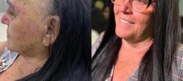 Técnicas capilares ajudam mulheres com alopecia a recuperar a autoestima