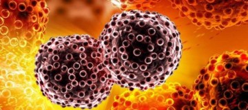 Tumores: Saúde Bucal - CEDDRO Radiologia e Tomografia Digital
