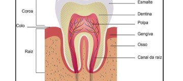 Reabsorção radicular - CEDDRO Radiologia e Tomografia Digital