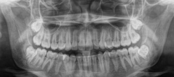 Técnicas radiográficas - CEDDRO Radiologia e Tomografia Digital