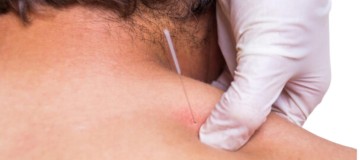 Dry Needling/Agulhamento a seco - Ceddro Radiologia e Tomografia Digital