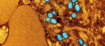 Mpox: saiba quais são os sintomas e formas de transmissão da doença