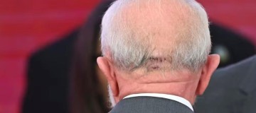 Lula é operado às pressas em São Paulo após sentir dor na cabeça