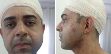 Advogado é espancado com chave de roda por motorista da Uber em BH