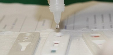 Ambulatório Herbert de Souza realiza testagem de ISTs neste sábado