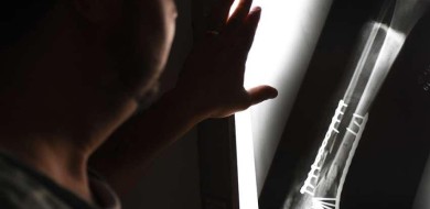 Mulher cai em buraco sem sinalização em MG, se machuca e é indenizada