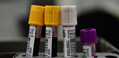 Hemorio inicia testes com plasma sanguíneo no tratamento de covid-19