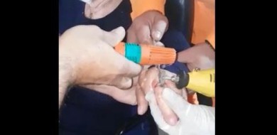 Idosa procura ajuda para serrar aliança que estrangulava o dedo