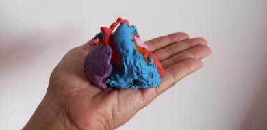 Médicos usam impressora 3D para cirurgia cardíaca em recém-nascido