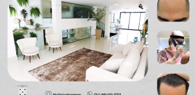 TRANSPLANTE FUE/DHI (Direct Hair Implantation) clinica BREMEN