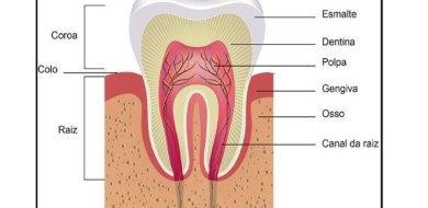 Reabsorção radicular - CEDDRO Radiologia e Tomografia Digital