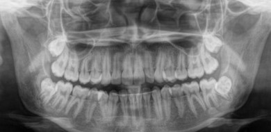 Técnicas radiográficas - CEDDRO Radiologia e Tomografia Digital
