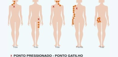 Pontos-gatilho - Ceddro Radiologia e Tomografia Digital