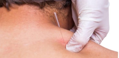 Dry Needling/Agulhamento a seco - Ceddro Radiologia e Tomografia Digital