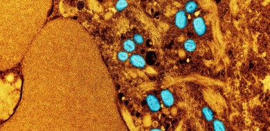 Mpox: saiba quais são os sintomas e formas de transmissão da doença